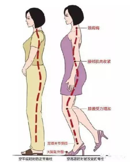 高跟鞋生理曲度.jpg